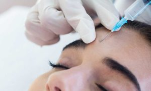 botox rancho cucamonga