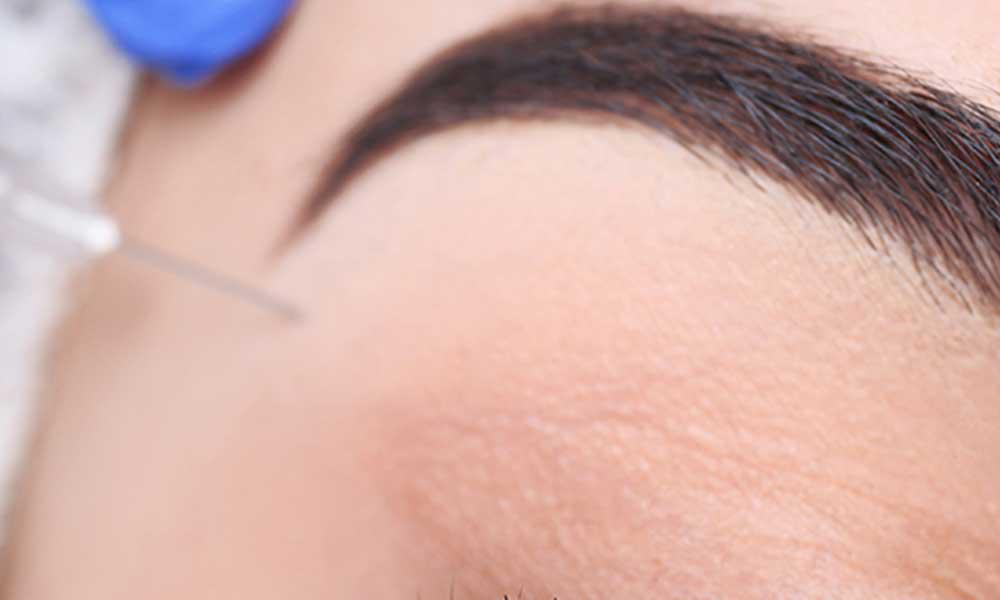 Dermal Fillers Rancho Cucamonga